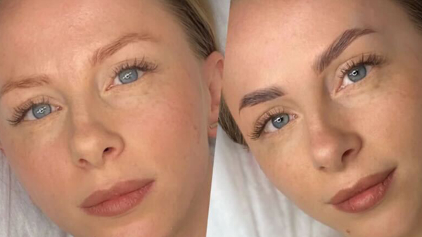 Obočie, ktoré omladzuje tvár