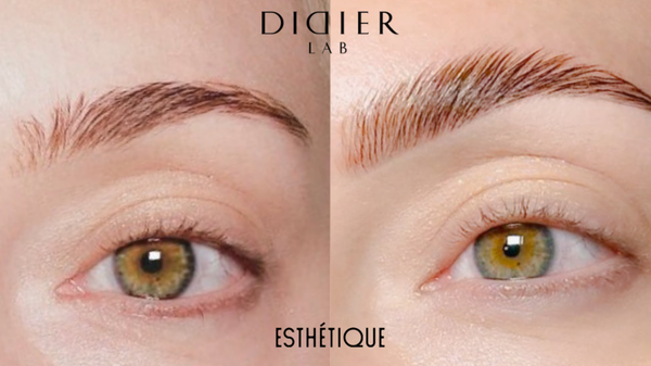 Prečo je analýza obočia pred ošetrením taká dôležitá?