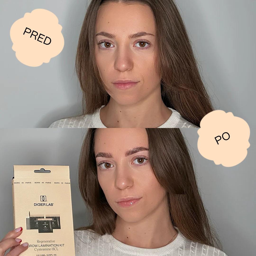 Regeneračná sada na lamináciu obočia ”Didier Lab”